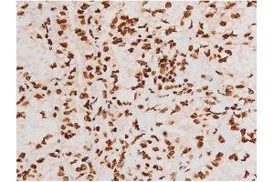 Image no. 4 for anti-REL proto-oncogene (c-Rel) (pSer503) antibody (ABIN6255382)