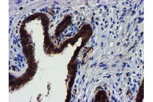 Image no. 11 for anti-Makorin Ring Finger Protein 1 (MKRN1) antibody (ABIN1499486)