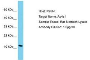 anti-Adaptor Related Protein Complex 4 sigma 1 (AP4s1) (AA 35-84) antibody