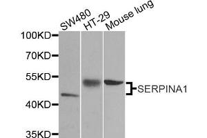 Image no. 2 for anti-serpin Peptidase Inhibitor, Clade A (Alpha-1 Antiproteinase, Antitrypsin), Member 1 (SERPINA1) antibody (ABIN3021276)