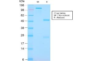 Image no. 1 for anti-S100 Calcium Binding Protein A8 (S100A8) antibody (ABIN6940549)