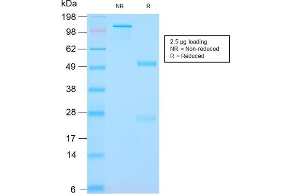 anti-S100 Calcium Binding Protein A8 (S100A8) antibody