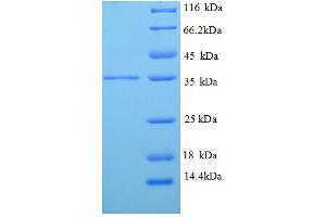 TPM2 Protein (AA 14-284, partial) (His tag)