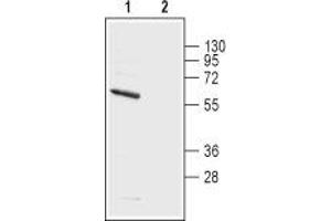 anti-Potassium Voltage-Gated Channel, Shaker-Related Subfamily, Member 5 (KCNA5) (1st Extracellular Loop), (AA 268-279) antibody
