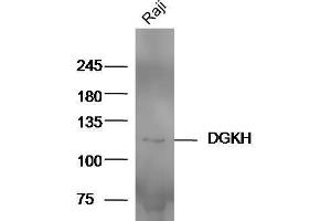 Image no. 2 for anti-Diacylglycerol Kinase, eta (DGKH) (AA 51-150) antibody (ABIN2559726)