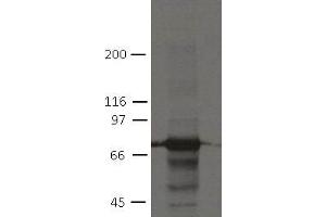 Image no. 1 for anti-Plakophilin 1 (PKP1) (AA 235-726) antibody (ABIN1169699)