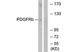 Western blot analysis of extracts from LOVO cells, using PDGF Receptor beta (Ab-751) Antibody.