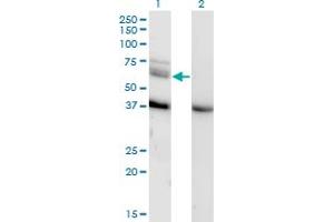 Image no. 1 for anti-Mitogen-Activated Protein Kinase Kinase Kinase 7 (MAP3K7) (AA 471-579) antibody (ABIN520691)