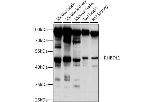 RHBDL1 antibody