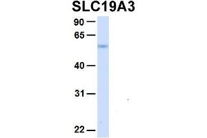 Image no. 2 for anti-Solute Carrier Family 19, Member 3 (Slc19a3) (Middle Region) antibody (ABIN2775519)