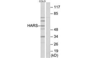 Image no. 1 for anti-Histidyl-tRNA Synthetase (HARS1) (AA 460-509) antibody (ABIN1533611)
