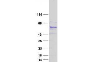 Image no. 1 for Atlastin GTPase 1 (ATL1) (Transcript Variant 1) protein (Myc-DYKDDDDK Tag) (ABIN2715027)