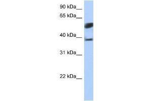 Image no. 1 for anti-Speckle-Type POZ Protein-Like (SPOPL) (N-Term) antibody (ABIN928326)