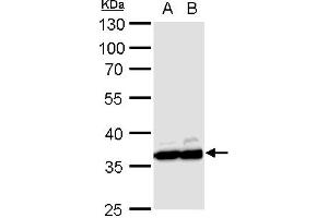 Image no. 4 for anti-Glyceraldehyde-3-Phosphate Dehydrogenase (GAPDH) (Center) antibody (ABIN2857072)