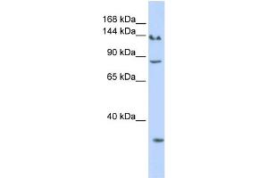 Image no. 1 for anti-SIN3 homolog A, transcription regulator (SIN3A) (N-Term) antibody (ABIN2779673)