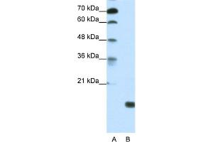 Image no. 1 for anti-TGFB-Induced Factor Homeobox 2-Like, Y-Linked (TGIF2LY) (Middle Region) antibody (ABIN2775066)