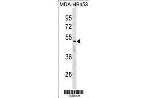 Western Blotting (WB) image for anti-Death Effector Domain Containing (DEDD) (Center) antibody (ABIN2160549)