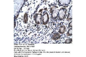 Image no. 7 for anti-Hematopoietic Cell-Specific Lyn Substrate 1 (HCLS1) (N-Term) antibody (ABIN2777503)