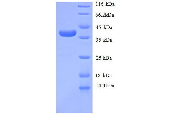 COL4A1 Protein (AA 30-167, partial) (GST tag)