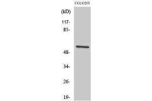 Image no. 1 for anti-IKAROS Family Zinc Finger 3 (Aiolos) (IKZF3) (Internal Region) antibody (ABIN3180687)