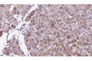 DBN1 antibody  (Internal Region)