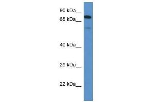 Image no. 1 for anti-UDP-N-Acetyl-alpha-D-Galactosamine:polypeptide N-Acetylgalactosaminyltransferase 3 (GalNAc-T3) (GALNT3) (N-Term) antibody (ABIN928110)