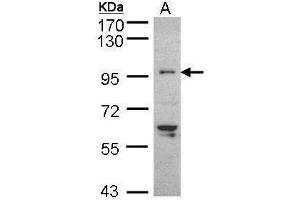 Image no. 2 for anti-TNNI3 Interacting Kinase (TNNI3K) (Internal Region) antibody (ABIN2856644)