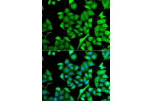 Image no. 1 for anti-N(alpha)-Acetyltransferase 50, NatE Catalytic Subunit (NAA50) antibody (ABIN6144327)
