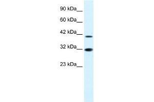 Image no. 1 for anti-Interferon Regulatory Factor 2 (IRF2) (N-Term) antibody (ABIN2792534)