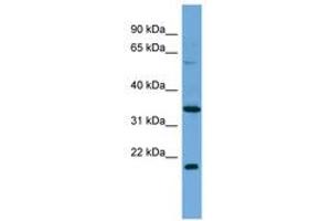 Image no. 1 for anti-Mesoderm Induction Early Response 1, Family Member 2 (MIER2) (C-Term) antibody (ABIN6745650)