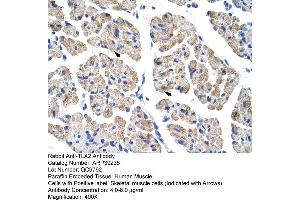 Image no. 1 for anti-T-Cell Leukemia Homeobox 2 (TLX2) (C-Term) antibody (ABIN2781001)