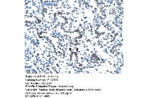 Image no. 1 for anti-EVX1 (EVX1) (N-Term) antibody (ABIN2792604)