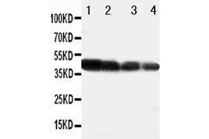 Image no. 1 for anti-delta Like Protein 3 (DLL3) (AA 599-618), (C-Term) antibody (ABIN3044121)