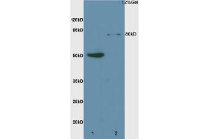 Image no. 2 for anti-MRE11 Meiotic Recombination 11 Homolog A (S. Cerevisiae) (MRE11A) (AA 451-550) antibody (ABIN747293)