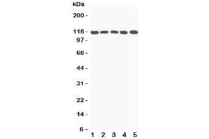 Image no. 1 for anti-Complement Component 5a (C5a) (N-Term) antibody (ABIN3029692)