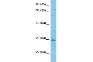 Image no. 5 for anti-F-Box and WD Repeat Domain Containing 7 (FBXW7) (C-Term) antibody (ABIN2782955)