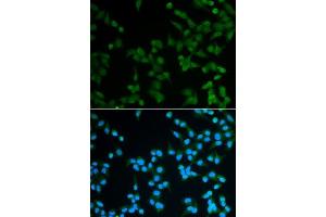 Image no. 4 for anti-Spindlin 1 (SPIN1) antibody (ABIN6148353)