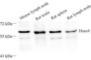Western blot analysis of Haus8 (ABIN7074162) at dilution of 1: 250