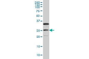 DCAKD antibody  (AA 113-200)