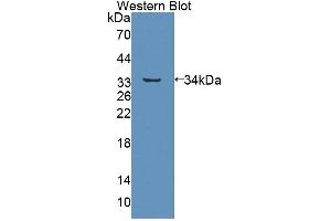 Image no. 1 for anti-ATP-Binding Cassette, Sub-Family B (MDR/TAP), Member 7 (ABCB7) (AA 472-752) antibody (ABIN5013185)