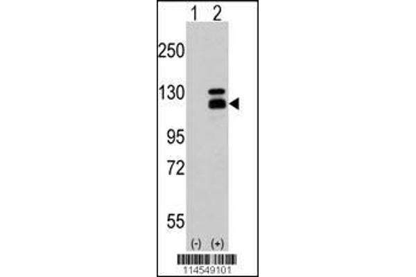 anti-PARG (PARG) (C-Term) antibody