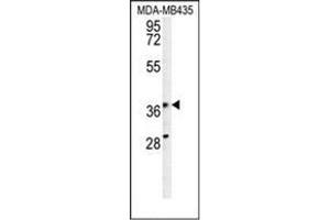 Image no. 2 for anti-phosphoribosyl Pyrophosphate Synthetase-Associated Protein 1 (PRPSAP1) (AA 66-96), (N-Term) antibody (ABIN954330)