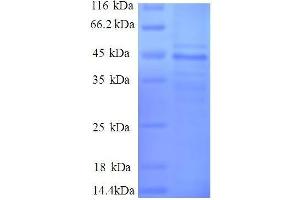 Myosin Light Chain 6, Alkali, Smooth Muscle and Non Muscle (MYL6) (AA 3-151), (partial) protein (GST tag)