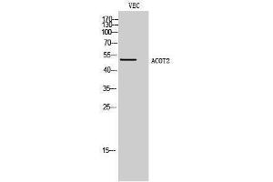 Image no. 1 for anti-Acyl-CoA Thioesterase 2 (ACOT2) (Internal Region) antibody (ABIN3183148)