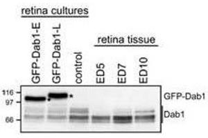 Image no. 2 for anti-Disabled Homolog 1 (Drosophila) (DAB1) (AA 400-555), (C-Term) antibody (ABIN6658036)