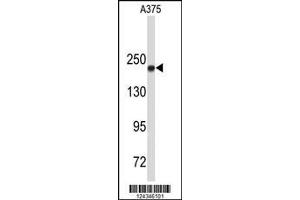 Image no. 1 for anti-Topoisomerase (DNA) II alpha 170kDa (TOP2A) (AA 1167-1196), (C-Term) antibody (ABIN653195)