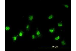 Image no. 6 for anti-NIMA (Never In Mitosis Gene A)-Related Kinase 11 (NEK11) (AA 1-482) antibody (ABIN566395)
