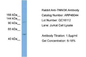 Image no. 1 for anti-TNNI3 Interacting Kinase (TNNI3K) (N-Term) antibody (ABIN2783204)