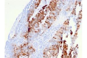 anti-Tumor Necrosis Factor Receptor Superfamily, Member 10b (TNFRSF10B) (AA 266-393) antibody