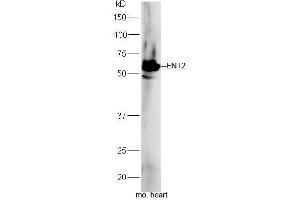 anti-Solute Carrier Family 29 (Nucleoside Transporters), Member 2 (SLC29A2) (AA 221-320) antibody